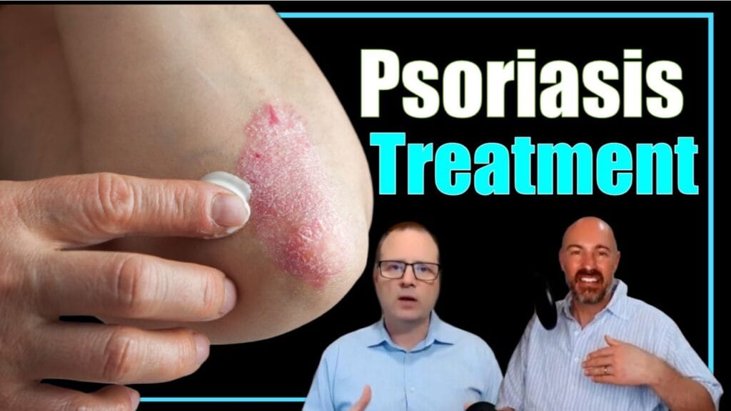 psoriasis naturally